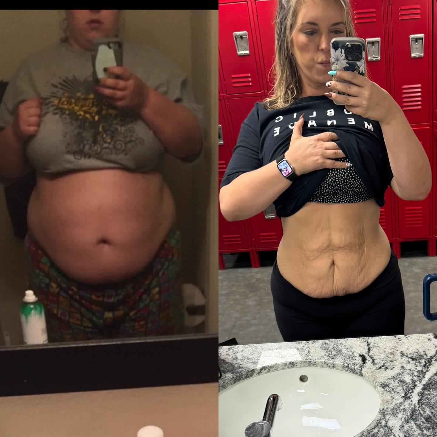 Witnessing the Reckoning: The Twisted Truth of the Weight Loss Obsession…